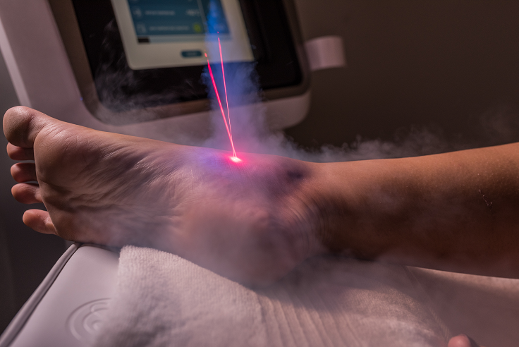 Crioterapia Caviglia